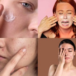 Bí quyết giúp da khỏe đẹp suốt mùa hè oi bức