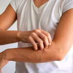 Ngứa kéo dài không rõ lý do có thể là tín hiệu sớm của suy thận