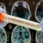 Phát hiện khoa học mới mở ra hy vọng kiểm soát bệnh Alzheimer