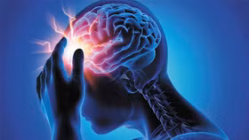 Nhồi máu não: Nguyên nhân, dấu hiệu và cách phòng ngừa hiệu quả