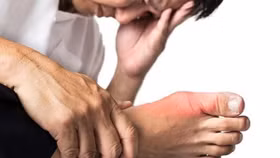 Kiểm soát bệnh gút ở đàn ông trung niên