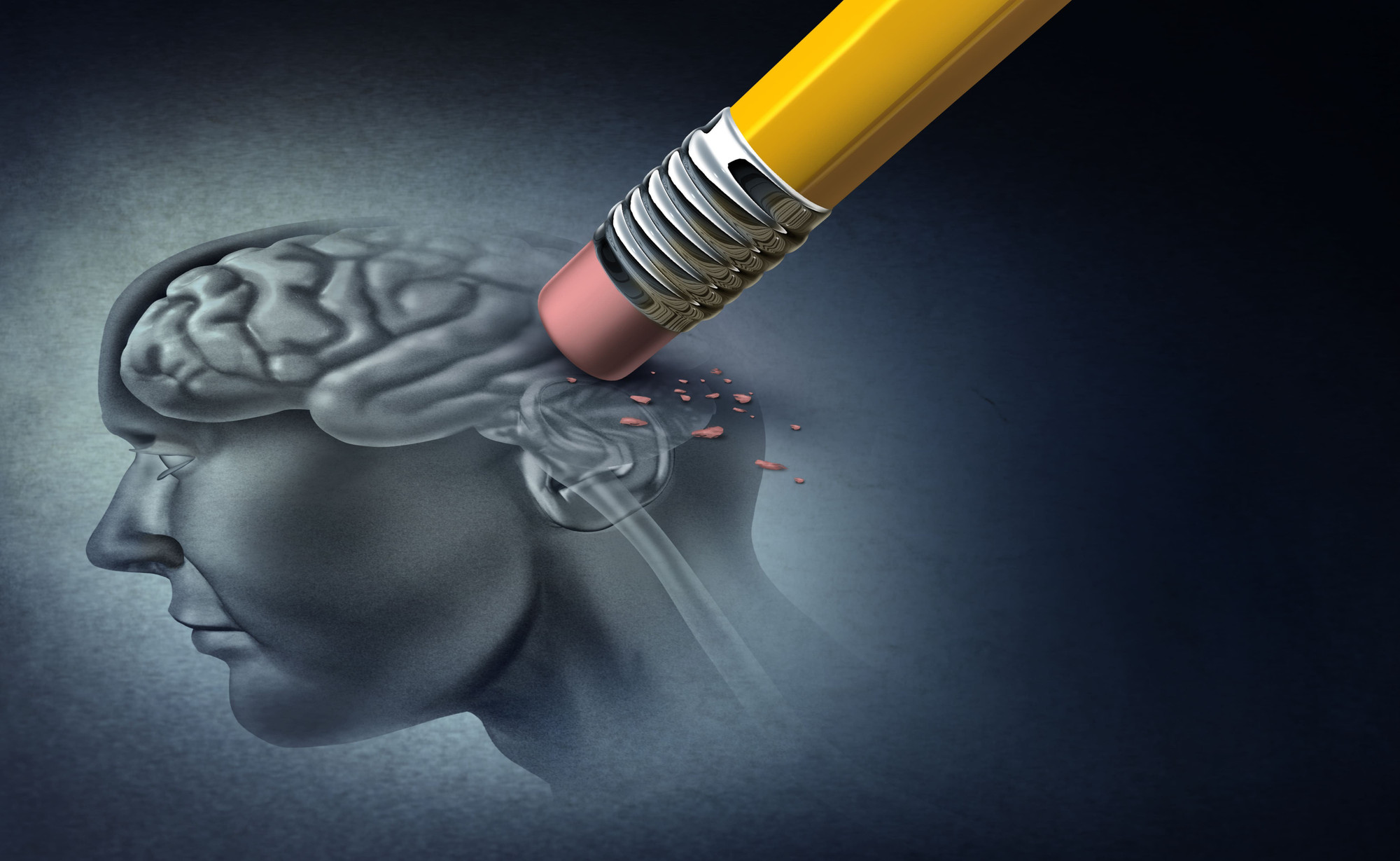 Mất ngủ mạn tính có liên quan mật thiết đến các bệnh lý thoái hóa thần kinh như Alzheimer dpr6qjxtxvsx8exzpvrmlr-1.jpg