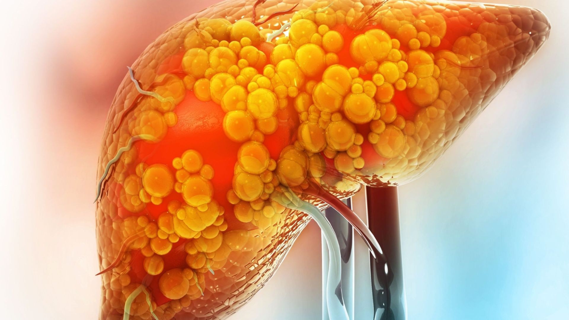 Nghiên cứu cho rằng ăn keto lâu dài có thể dẫn đến gan nhiễm mỡ gan.jpg