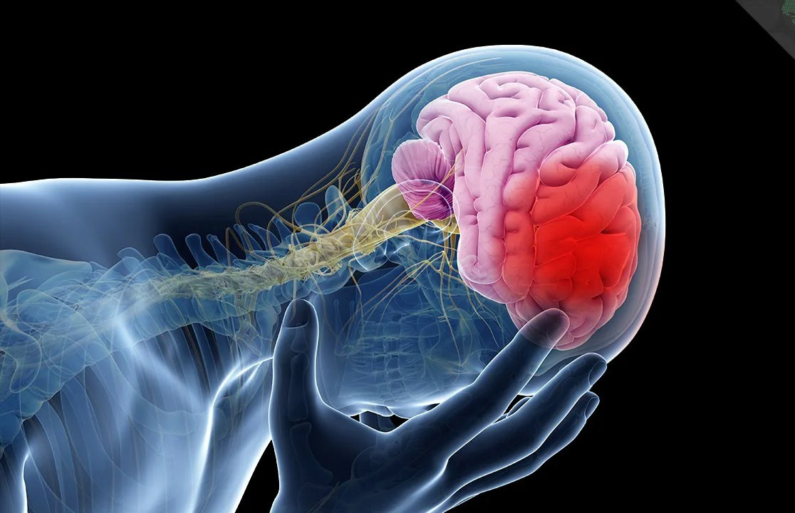 Người bị đột quỵ có thể rơi vào tình trạng cực kỳ nguy hiểm nếu không được cấp cứu kịp thời edit-maxresdefault-1696906322254241038918.jpg
