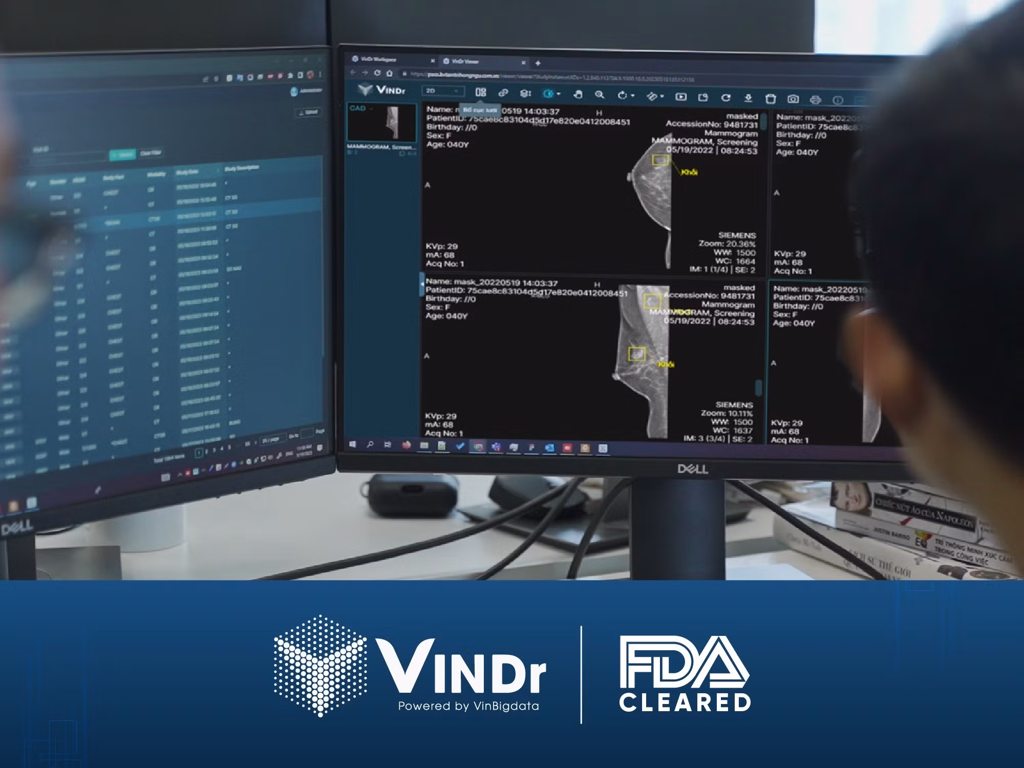 vindr.jpg