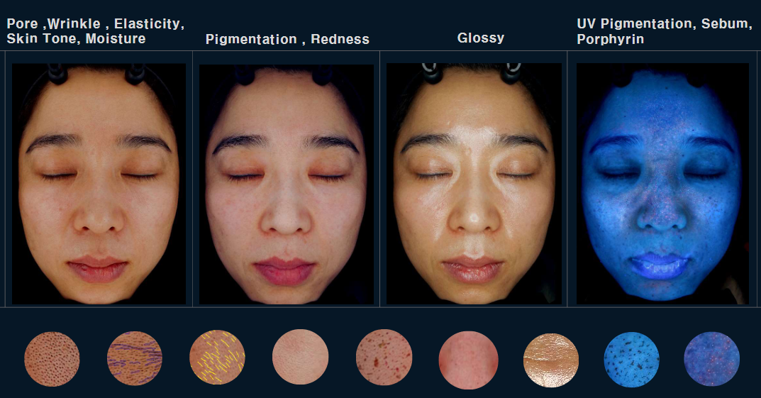 Các loại máy phân tích da có thể giúp chúng ta đo lường nhiều yếu tố của da ccc-1.png