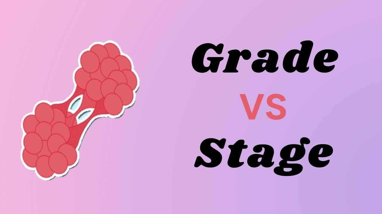 Nhiều người không phân biệt được 2 thuật ngữ trong chẩn đoán ung thư là "grade" và "stage" grade-of-the-disease-and-stage-of-the-disease.jpg