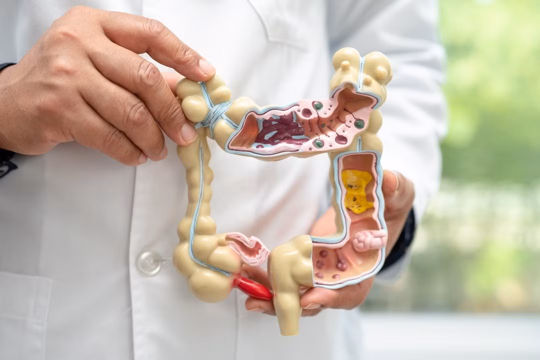 intestine-appendix-and-digestive-system-doctor-h-2023-06-21-23-14-14-utc-1.jpg