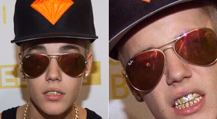 Grillz - Mốt đính kim cương lên răng cực chất của các ngôi sao-12