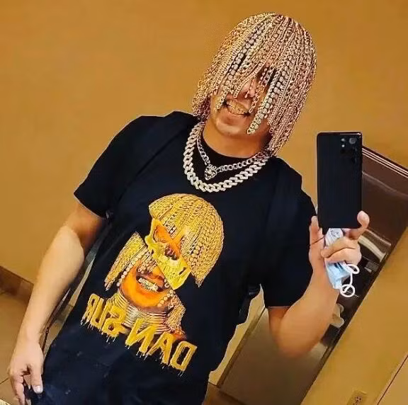 Nam rapper cấy tóc bằng dây chuyền vàng-2