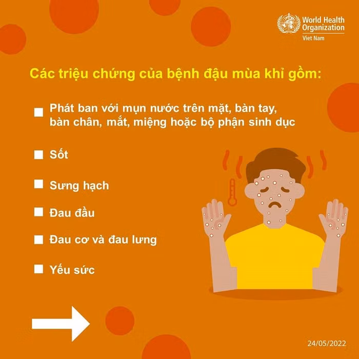 Các triệu chứng của bệnh đậu mùa khỉ