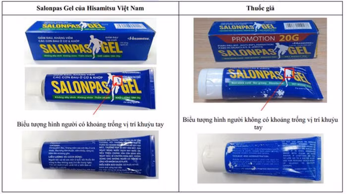 Hình ảnh so sánh Salonpas Gel thật (trái) và Salonpas Gel giả (phải)