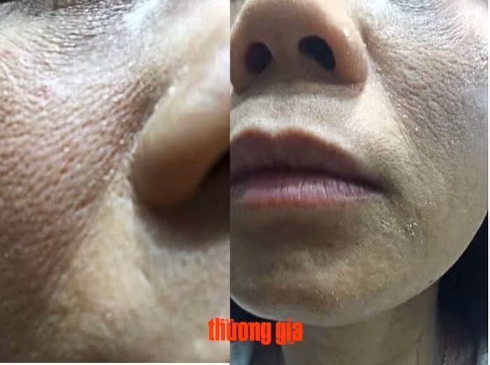 Tiếp vụ dị ứng mỹ phẩm Shiseido: Dư luận hoang mang ảnh 1