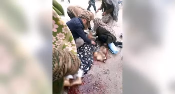 Một bức ảnh không xác định trên mạng xã hội, được cho là một phụ nữ bị Taliban bắn do không mặc áo choàng burqa.