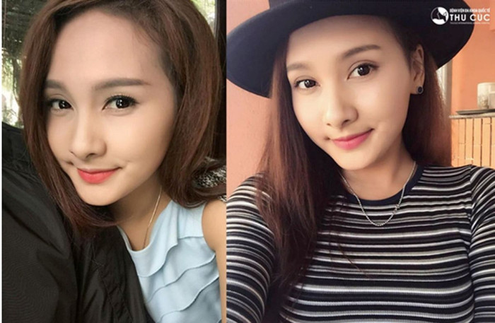 Điểm danh những ca phẫu thuật thẩm mỹ “lột xác” gây bão mạng ảnh 1