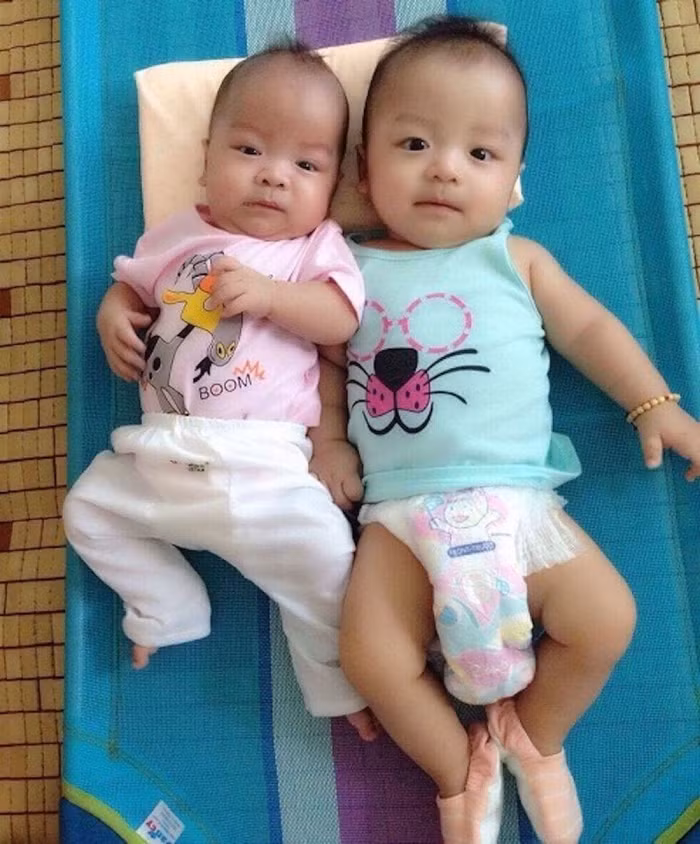 Ghép tế bào gốc cứu sống ngoạn mục bé trai sinh non bị xơ phổi ảnh 2