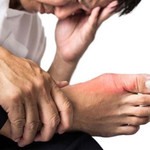 Kiểm soát bệnh gút ở đàn ông trung niên