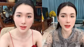 Từng gây xôn xao vì lùm xùm với Ngân 98, Ngân Collagen sở hữu khối tài sản khủng ra sao?