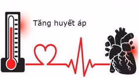 Giải pháp giúp kiểm soát huyết áp cho người có nhiều bệnh mạn tính