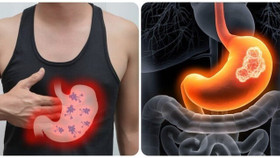 5 triệu chứng buổi sáng cảnh báo ung thư dạ dày