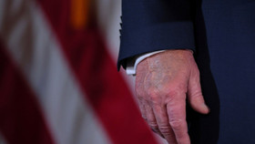 Hình ảnh cho thấy mu bàn tay của ông Trump bị bầm tím. Ảnh: Reuters