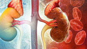 9 dấu hiệu cảnh báo suy thận, người trẻ cần chú ý