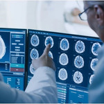 Cách AI giúp đẩy nhanh quá trình điều trị ung thư