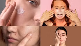 Bí quyết giúp da khỏe đẹp suốt mùa hè oi bức