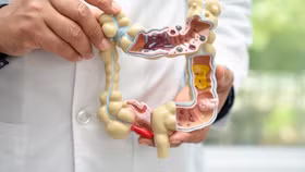 "Vũ khí" mới trong điều trị ung thư