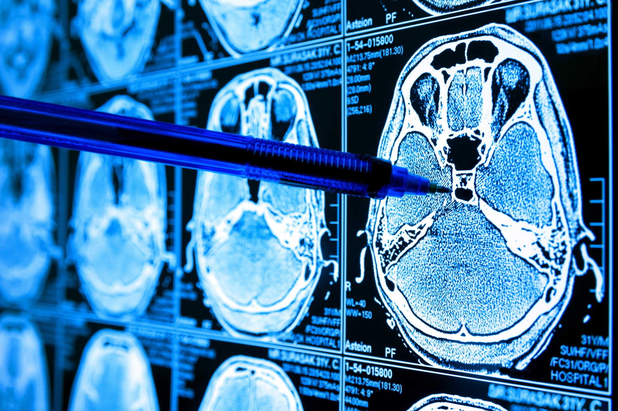 ai-and-cancer-detection.jpg