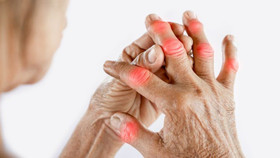 Bệnh thấp khớp có thể trở thành "sát thủ thầm lặng" gây tổn thương tới cả tim, phổi và thận 