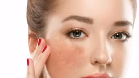 Tìm hiểu sản phẩm giúp giảm thâm nám đến từ thương hiệu Eucerin