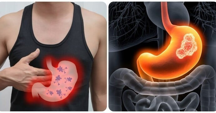 5 triệu chứng buổi sáng cảnh báo ung thư dạ dày