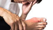 Kiểm soát bệnh gút ở đàn ông trung niên