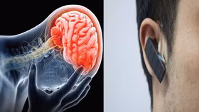 Cảnh báo: Tai nghe không dây có thể gây ung thư