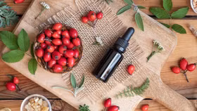 "Săn lùng" bí kíp làm đẹp của công nương Kate Middleton và siêu mẫu Miranda Kerr