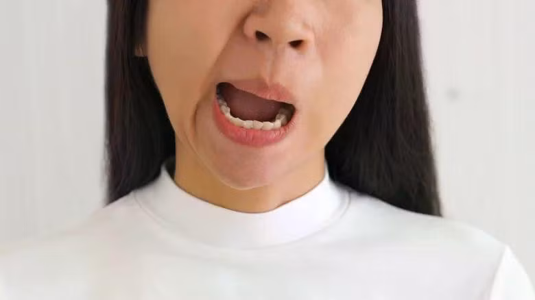 facial-drooping.jpg