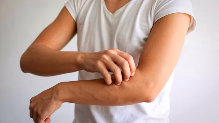 Ngứa kéo dài không rõ lý do có thể là tín hiệu sớm của suy thận