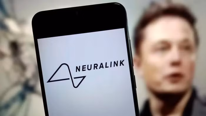 Công ty chip của Elon Musk lần đầu tiên thí nghiệm trên não bộ con người