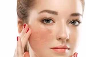 Tìm hiểu sản phẩm giúp giảm thâm nám đến từ thương hiệu Eucerin