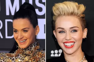 Grillz - Mốt đính kim cương lên răng cực chất của các ngôi sao