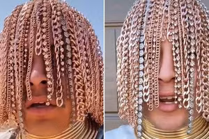 Nam rapper cấy tóc bằng dây chuyền vàng