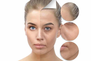 5 sản phẩm chứa collagen cho một làn da trẻ trung, căng mọng