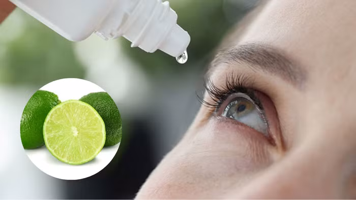Nhỏ chanh vào mắt là sai lầm nghiêm trọng gây hại thị lực