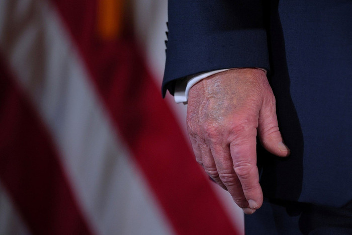 Hình ảnh cho thấy mu bàn tay của ông Trump bị bầm tím. Ảnh: Reuters