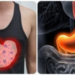 5 triệu chứng buổi sáng cảnh báo ung thư dạ dày