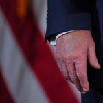 Hình ảnh cho thấy mu bàn tay của ông Trump bị bầm tím. Ảnh: Reuters