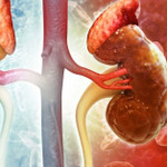 9 dấu hiệu cảnh báo suy thận, người trẻ cần chú ý