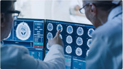 Cách AI giúp đẩy nhanh quá trình điều trị ung thư