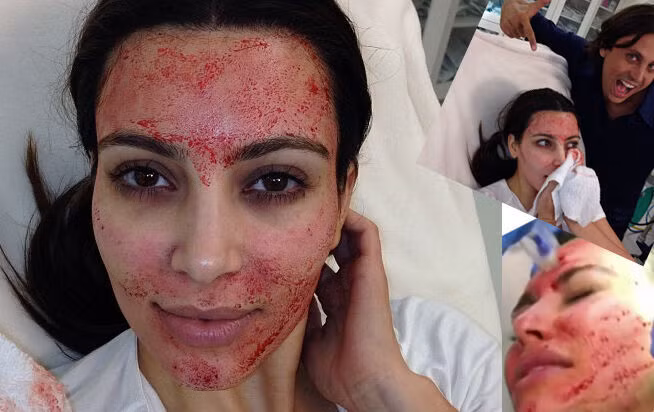 Những liệu trình dưỡng da kì quặc được các ngôi sao ưa chuộng ảnh 1